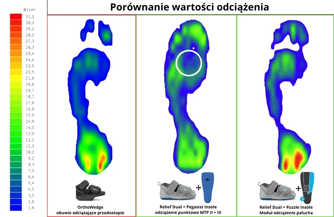 Por&oacute;wnanie pedobarograficzne buta odciążającego OrthoWedge z butem pooperacyjnym Relief Dual z wkładkami odciążającymi Pegassist i Puzzle Insole