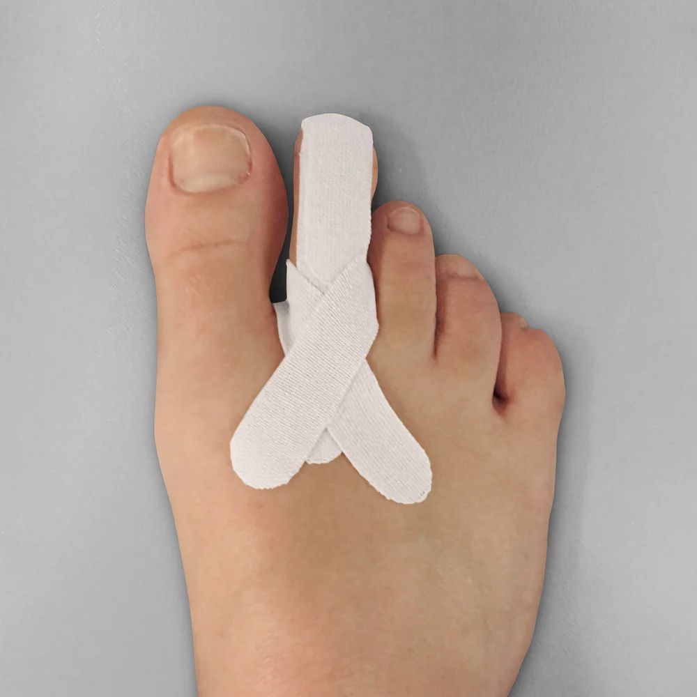 Aplikacja MECRON RDS przy palcach młotkowatych