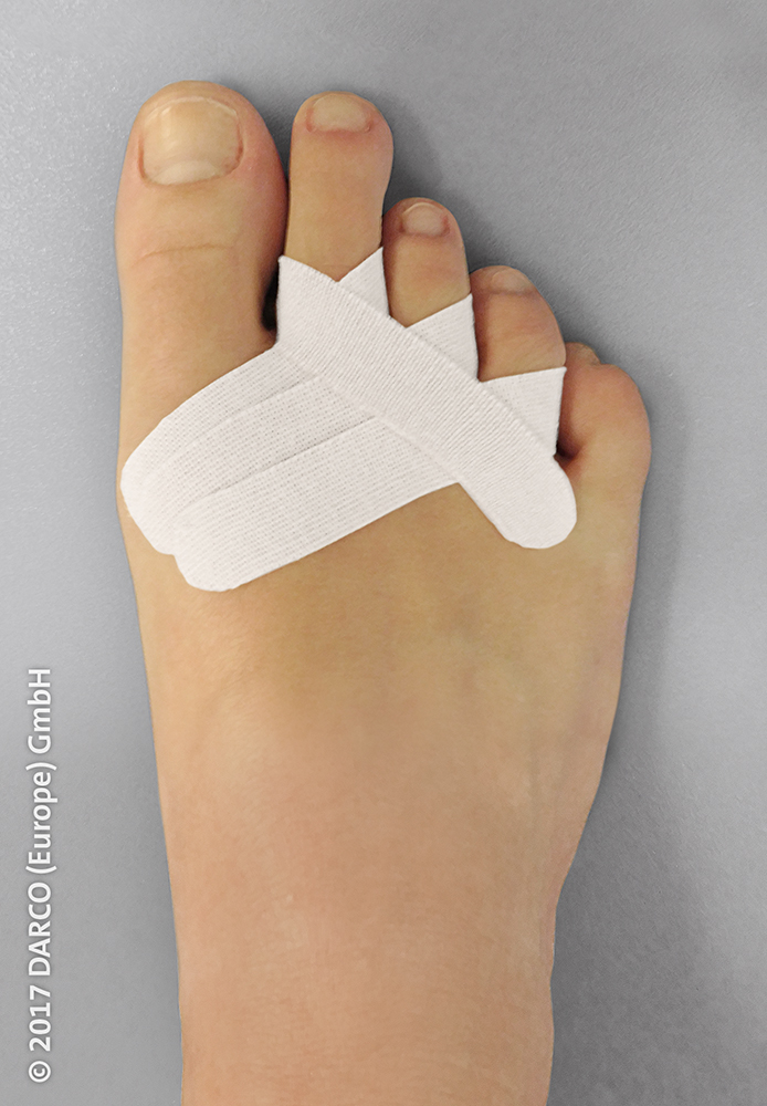 Aplikacja MECRON RDS w procedurze DMMO